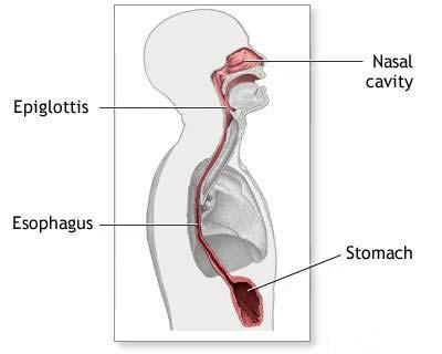 poza despre perforatia esofagului